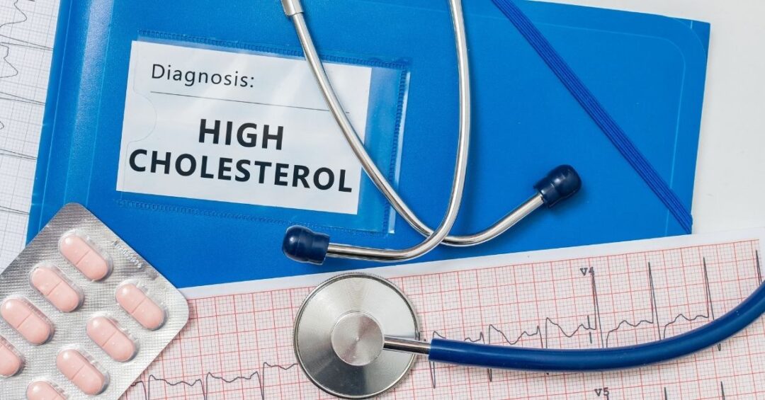 Medizinische Unterlagen mit Stethoskop und Hinweis auf hohes Cholesterin als Symbol für wichtige Laborwerte und Herz-Kreislauf-Gesundheit.